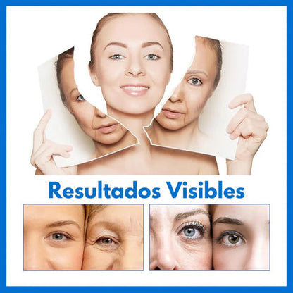 Botox Stock Solution suero antiarruga X 2